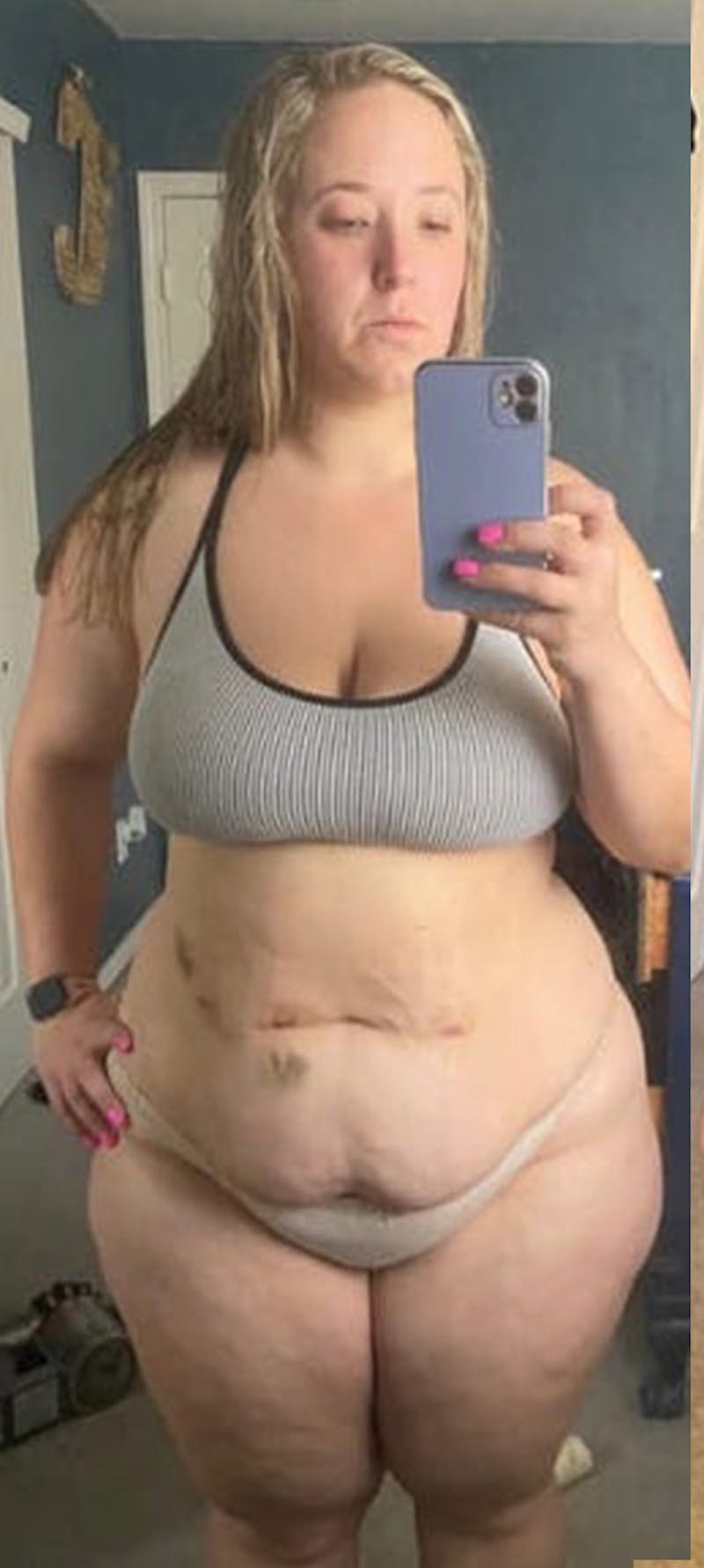 Patients 20-39 Years Old Before & After Gallery - Patient 122434615 - Image 1