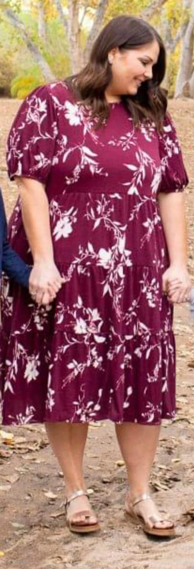 Patients 20-39 Years Old Before & After Gallery - Patient 128851327 - Image 1