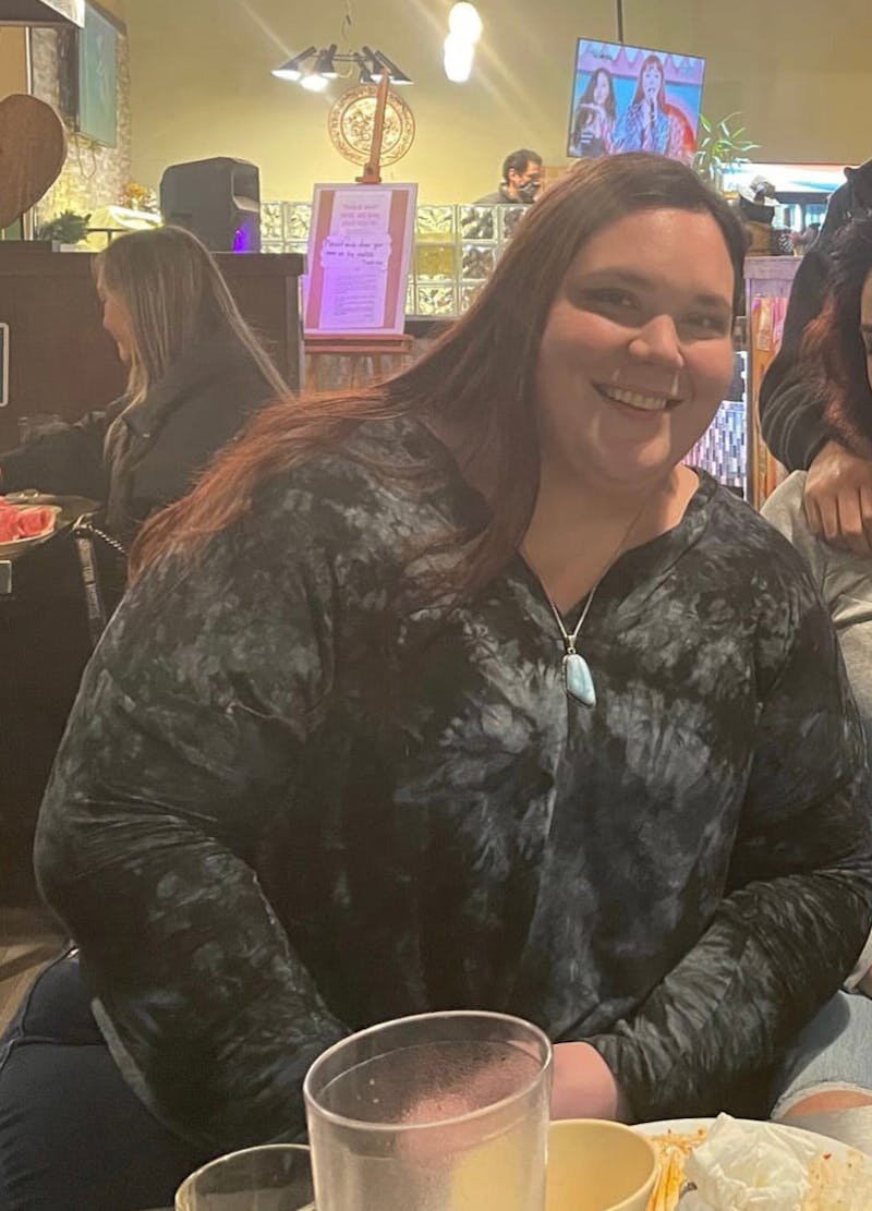 Patients 20-39 Years Old Before & After Gallery - Patient 128851325 - Image 1