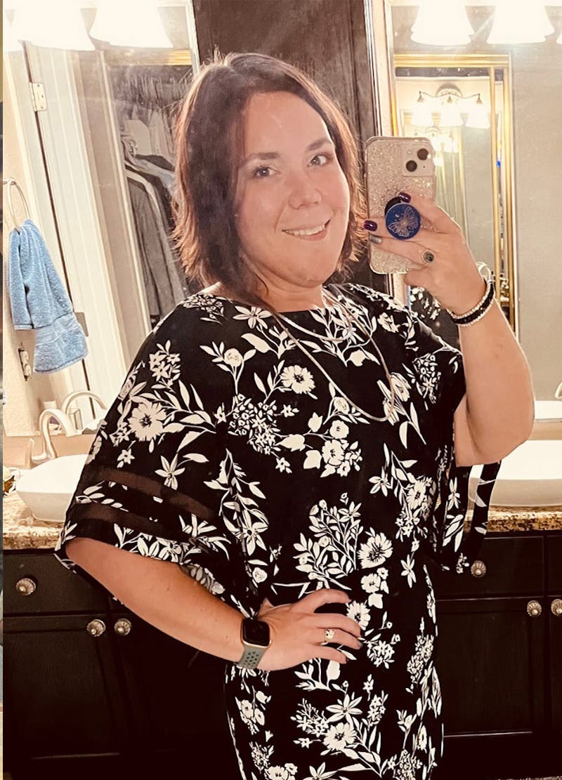 Patients 20-39 Years Old Before & After Gallery - Patient 128851325 - Image 2