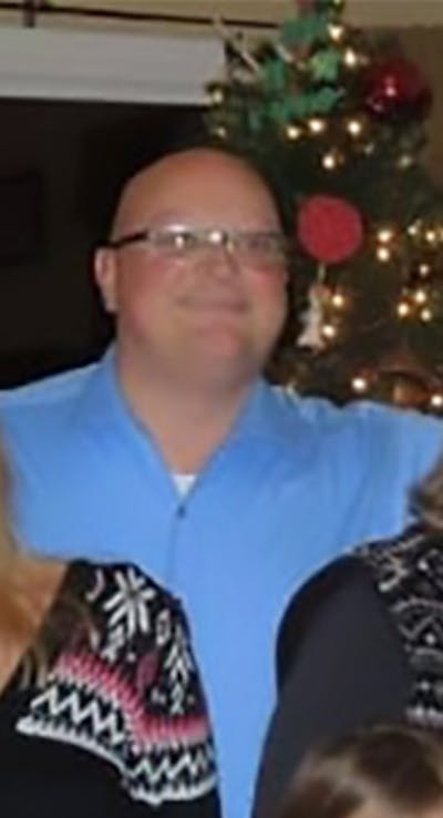 Patients 40-59 Years Old Before & After Gallery - Patient 559041 - Image 1