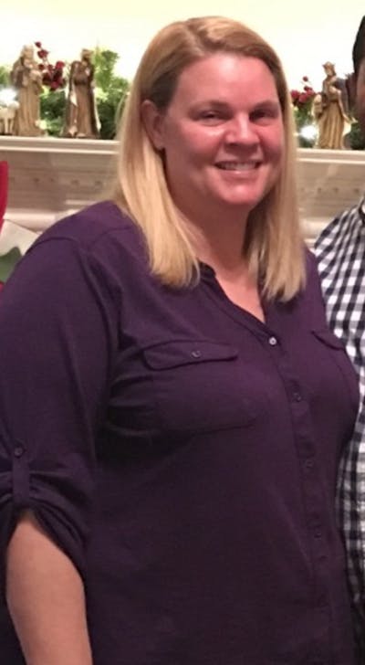 Patients 40-59 Years Old Before & After Gallery - Patient 139633846 - Image 1