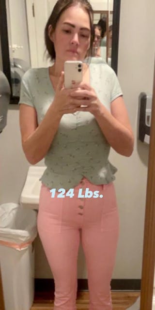 Patients 20-39 Years Old Before & After Gallery - Patient 142721540 - Image 2