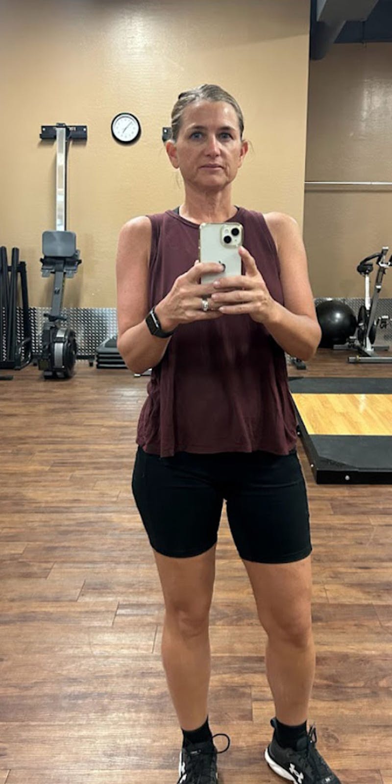 Patients 40-59 Years Old Before & After Gallery - Patient 176756882 - Image 2