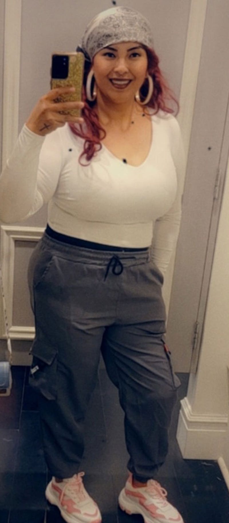 Patients 20-39 Years Old Before & After Gallery - Patient 182122195 - Image 2