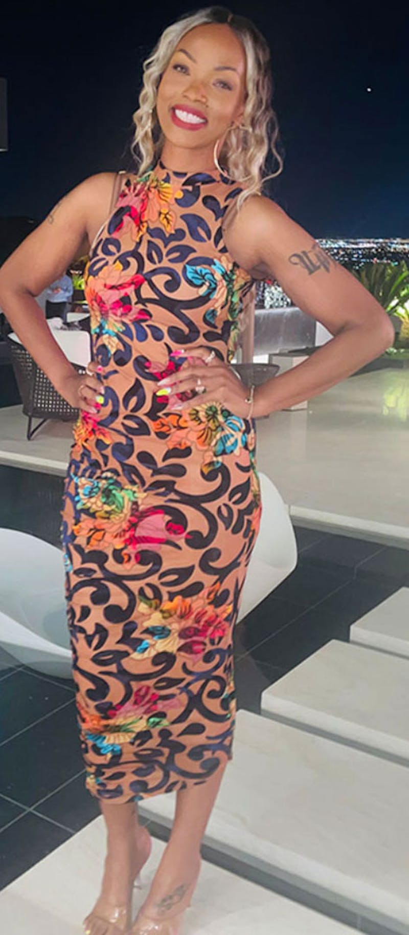 Patients 20-39 Years Old Before & After Gallery - Patient 182122196 - Image 2