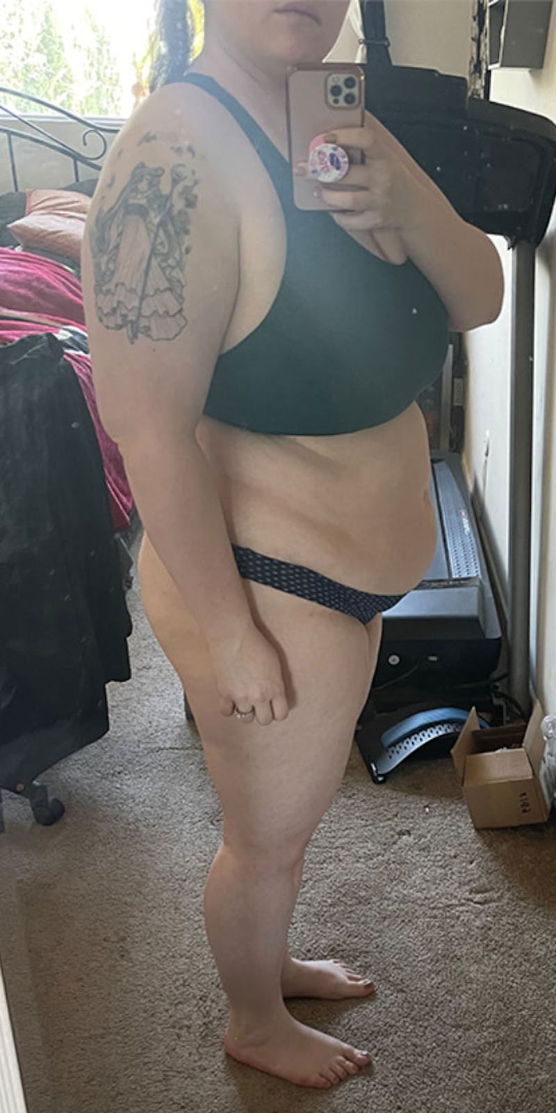 Patients 20-39 Years Old Before & After Gallery - Patient 185720191 - Image 1