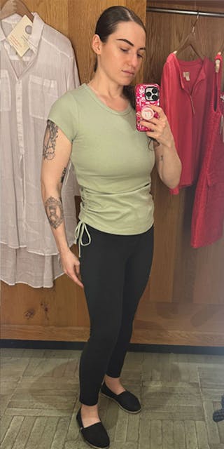 Patients 20-39 Years Old Before & After Gallery - Patient 185720191 - Image 2