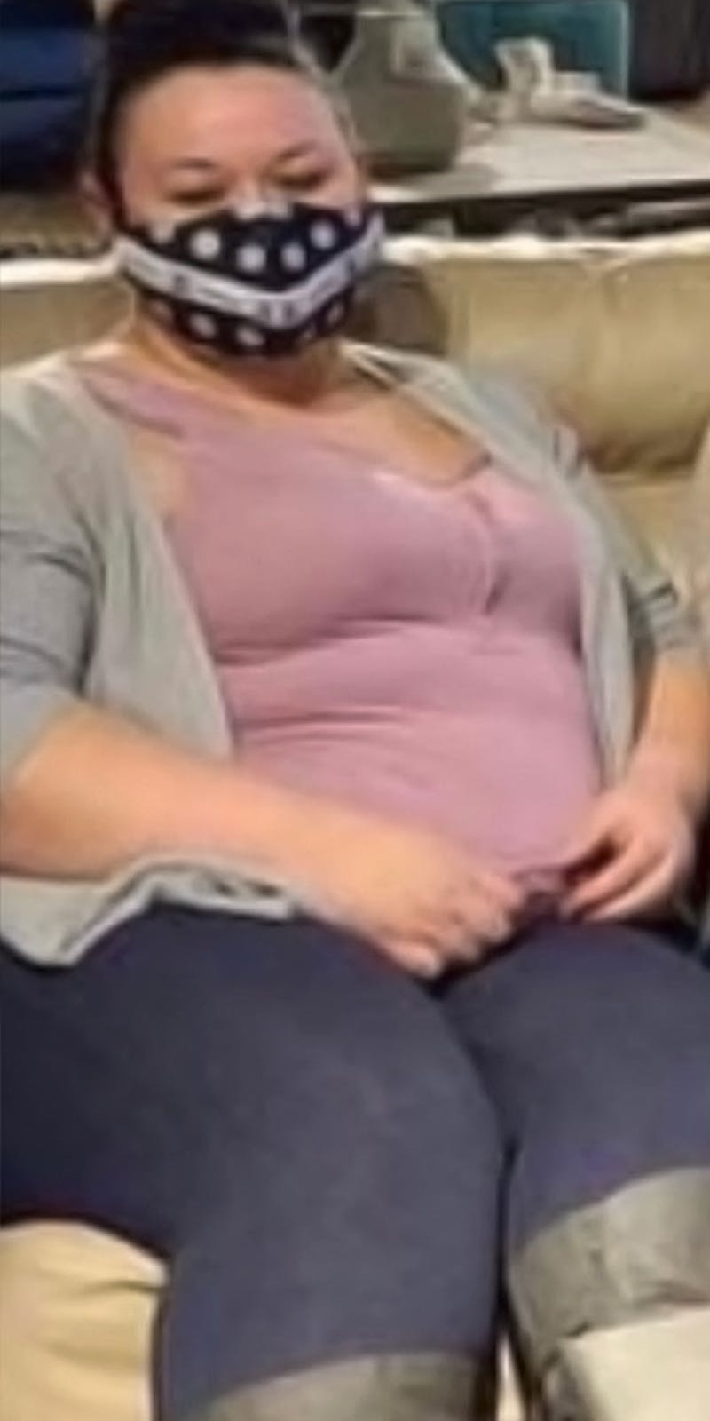 Patients 20-39 Years Old Before & After Gallery - Patient 185720190 - Image 1