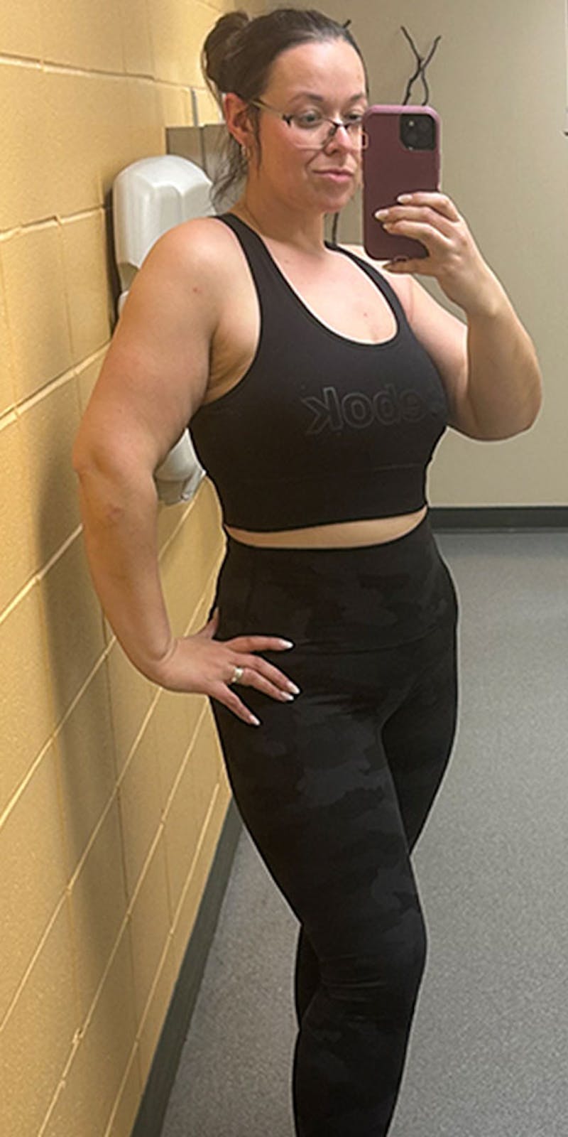 Patients 20-39 Years Old Before & After Gallery - Patient 185720190 - Image 2