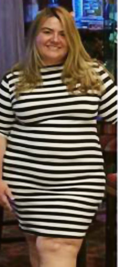 Patients 40-59 Years Old Before & After Gallery - Patient 189887538 - Image 1