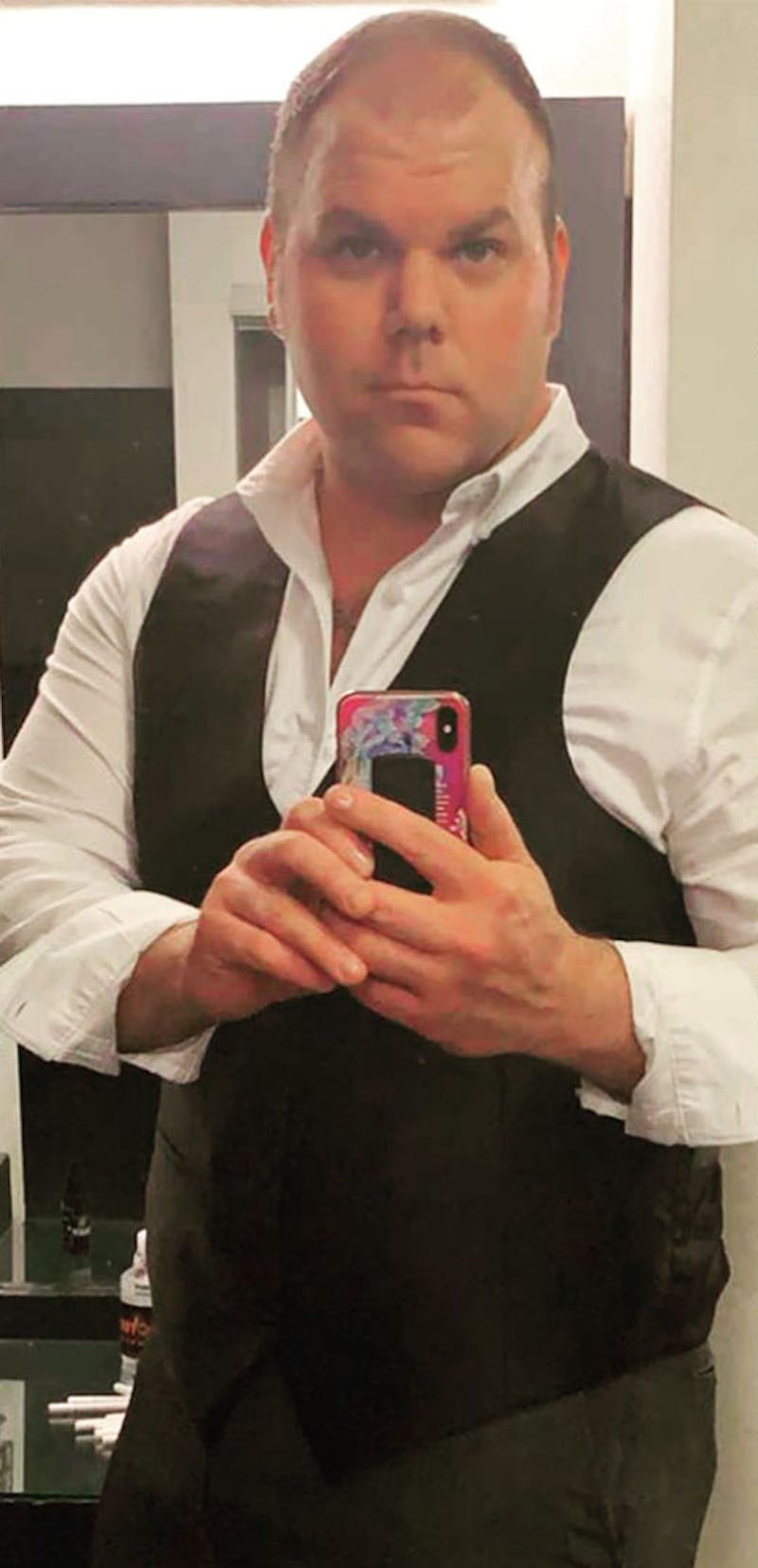 Patients 20-39 Years Old Before & After Gallery - Patient 189887628 - Image 1