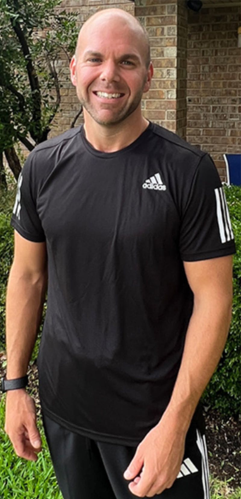 Patients 20-39 Years Old Before & After Gallery - Patient 189887628 - Image 2