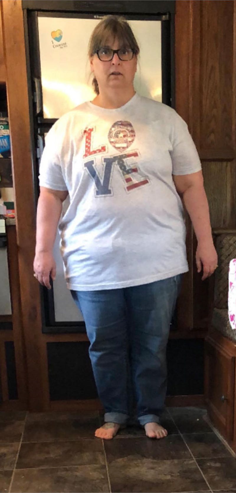 Patients 40-59 Years Old Before & After Gallery - Patient 189887627 - Image 1