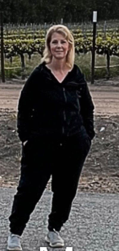 Patients 40-59 Years Old Before & After Gallery - Patient 191226281 - Image 1