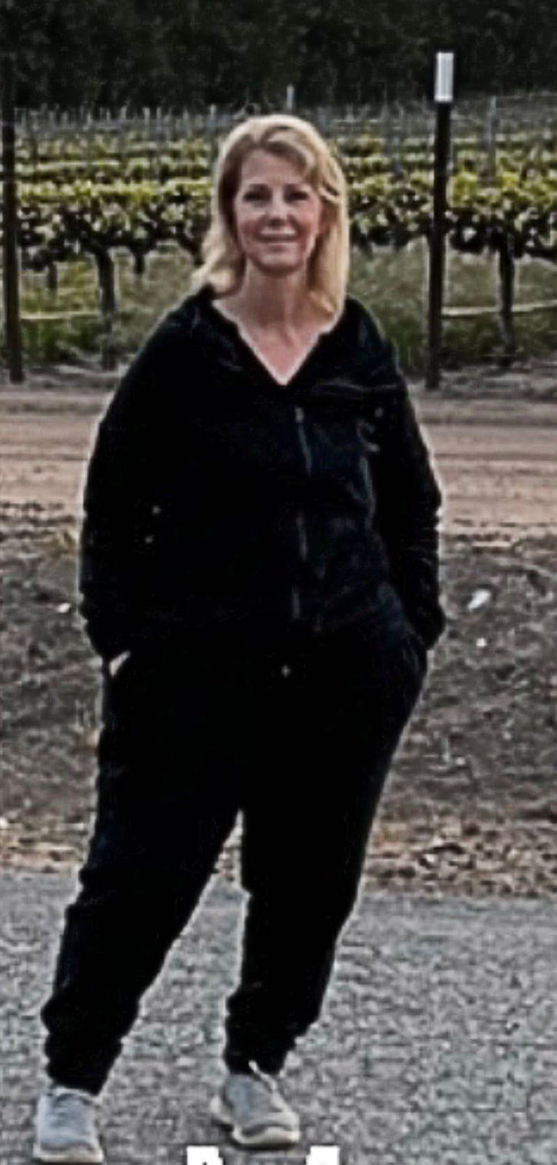 Patients 40-59 Years Old Before & After Gallery - Patient 191226281 - Image 1