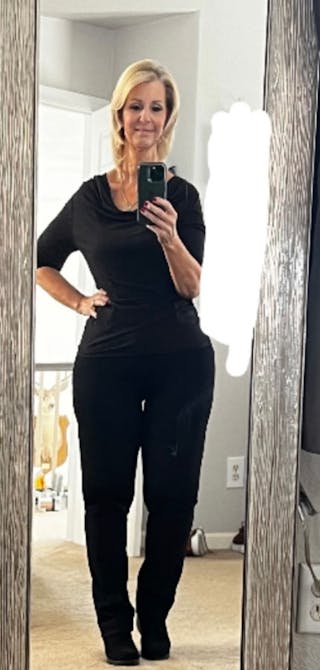 Patients 40-59 Years Old Before & After Gallery - Patient 191226281 - Image 2