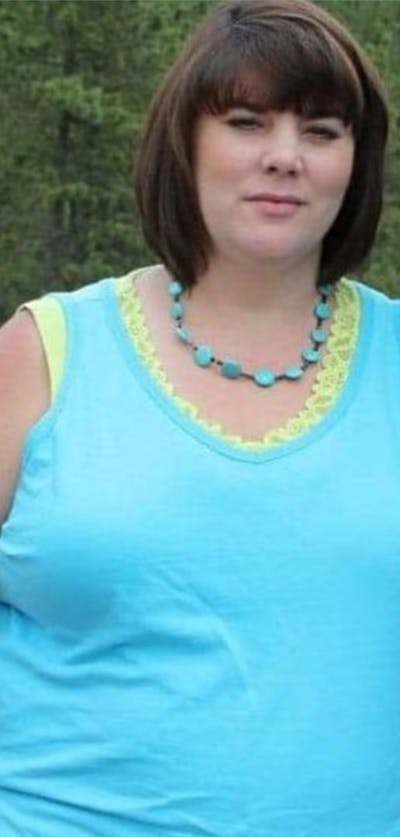 Patients 40-59 Years Old Before & After Gallery - Patient 191226283 - Image 1