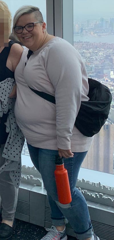 Patients 40-59 Years Old Before & After Gallery - Patient 191228501 - Image 1