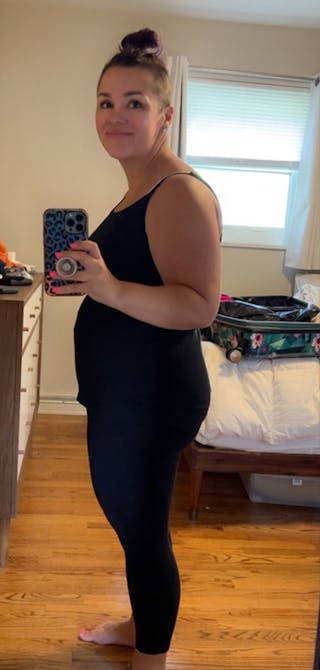 Patients 40-59 Years Old Before & After Gallery - Patient 191228501 - Image 2