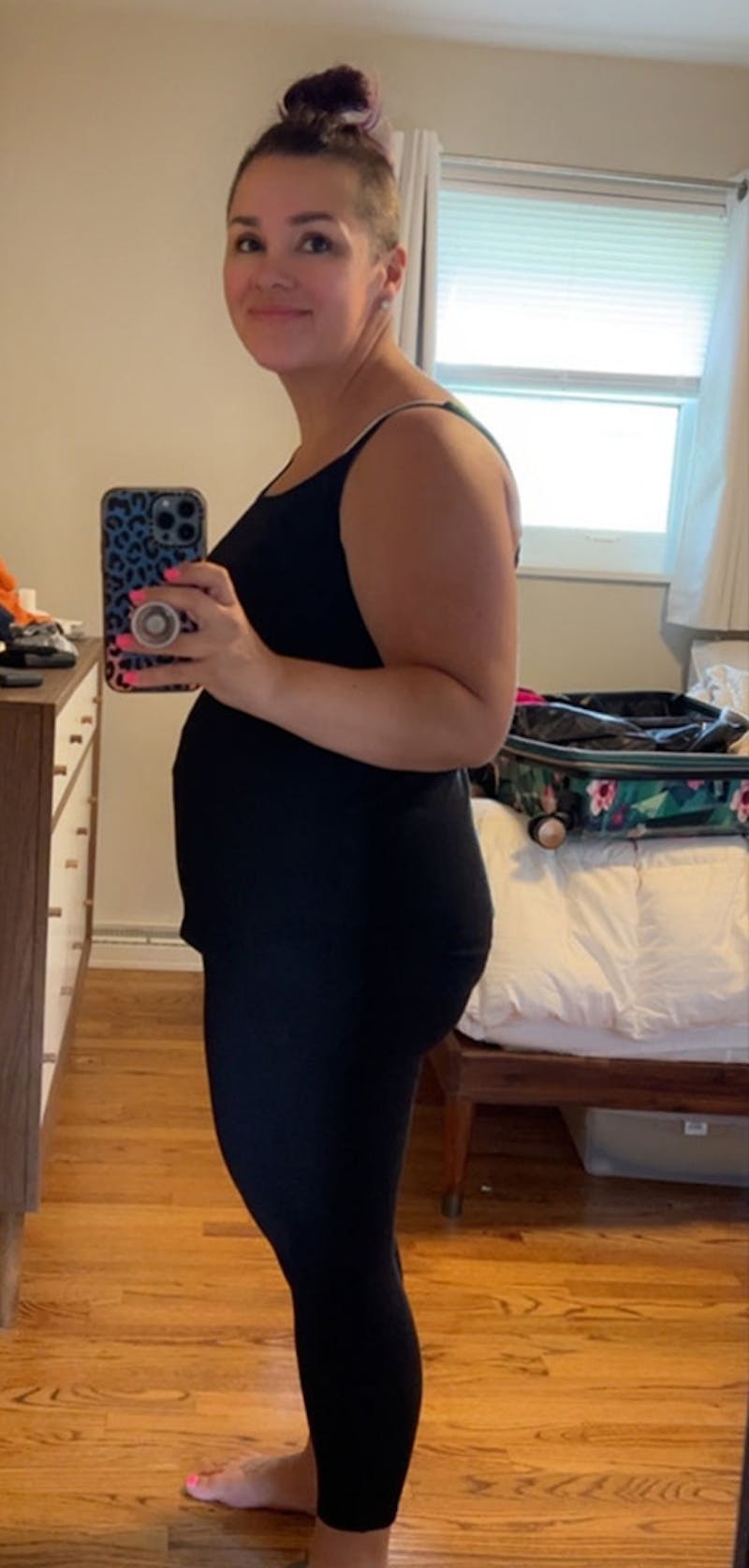 Patients 40-59 Years Old Before & After Gallery - Patient 191228501 - Image 2