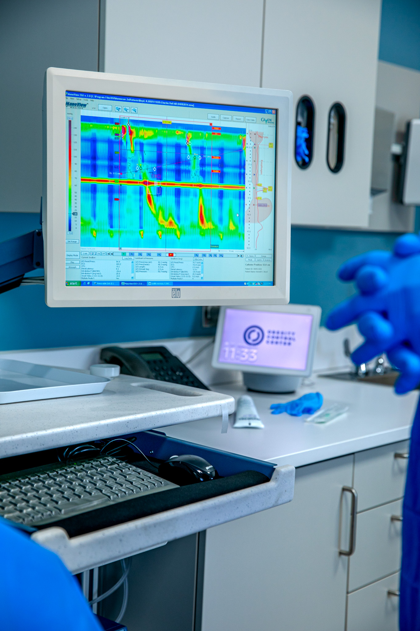 High Resolution Manometry | Obesity Control Center