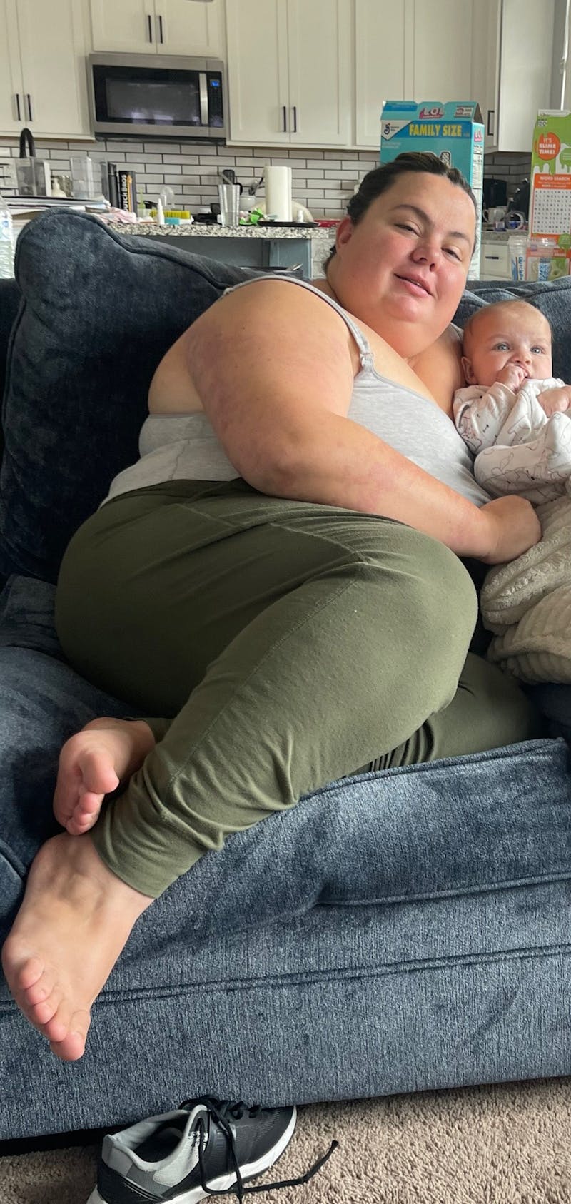 Patients 20-39 Years Old Before & After Gallery - Patient 106233 - Image 1