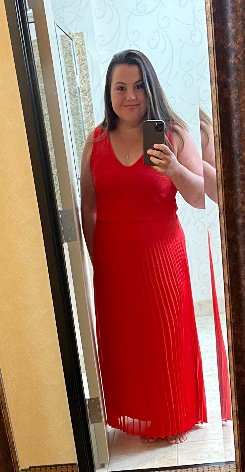 Patients 20-39 Years Old Before & After Gallery - Patient 106233 - Image 2