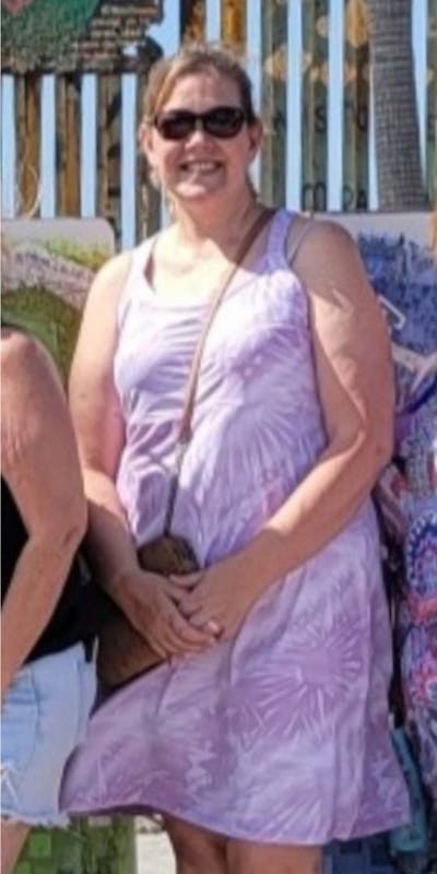 Patients 40-59 Years Old Before & After Gallery - Patient 995137 - Image 1