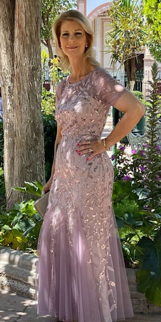 Patients 40-59 Years Old Before & After Gallery - Patient 251814 - Image 2