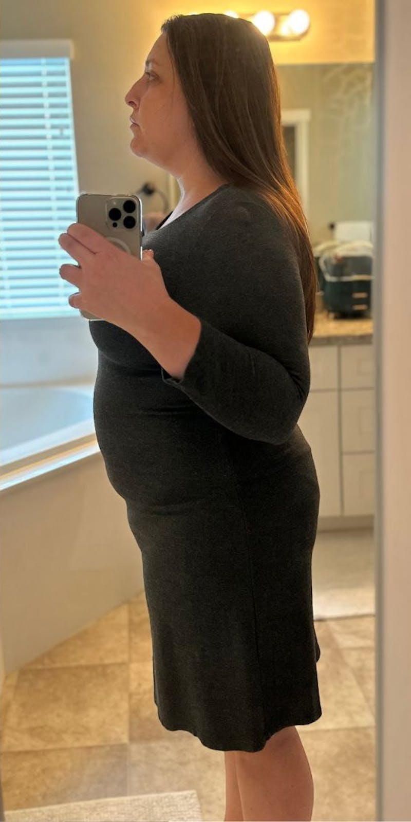 Patients 20-39 Years Old Before & After Gallery - Patient 303379 - Image 1