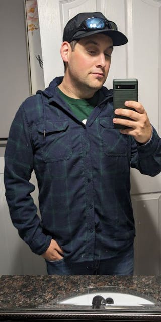 Patients 20-39 Years Old Before & After Gallery - Patient 242552 - Image 2