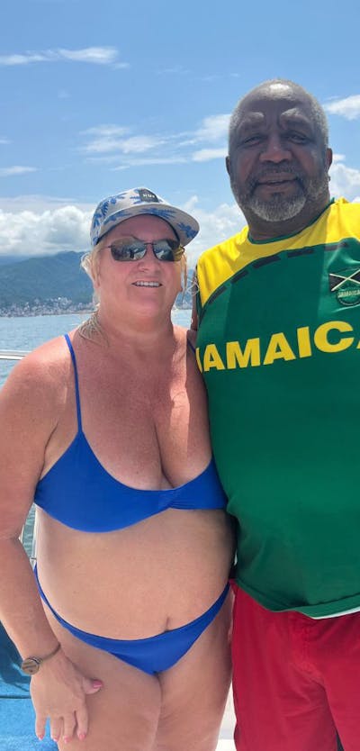 Patients 40-59 Years Old Before & After Gallery - Patient 158814 - Image 1