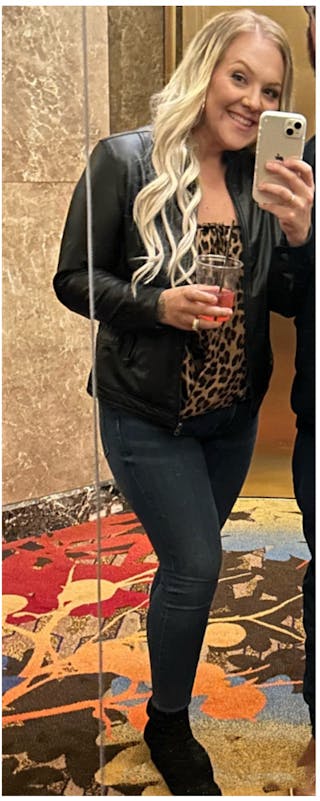 Patients 20-39 Years Old Before & After Gallery - Patient 315662 - Image 2