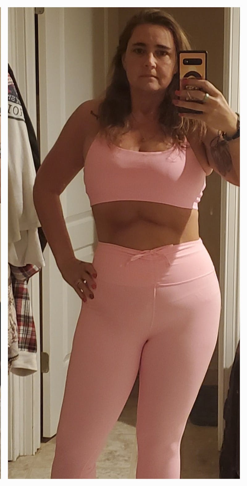 Patients 40-59 Years Old Before & After Gallery - Patient 584771 - Image 2