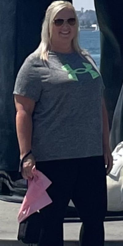 Patients 40-59 Years Old Before & After Gallery - Patient 181231 - Image 1