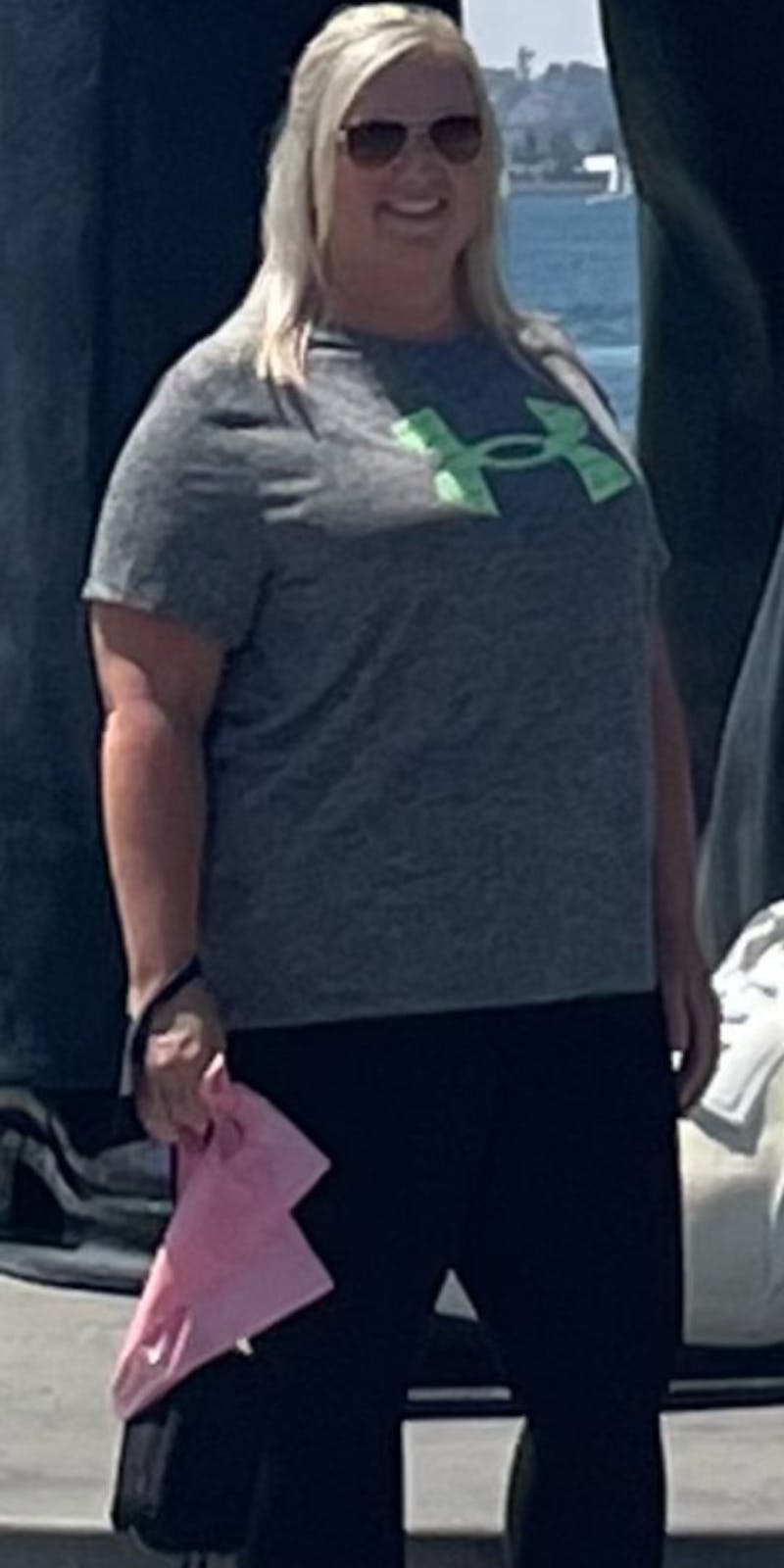 Patients 40-59 Years Old Before & After Gallery - Patient 181231 - Image 1