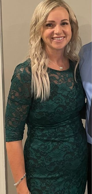 Patients 40-59 Years Old Before & After Gallery - Patient 181231 - Image 2