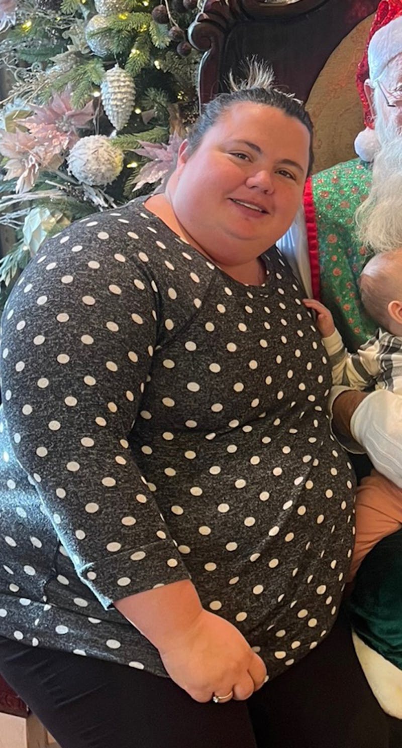 Patients 20-39 Years Old Before & After Gallery - Patient 217716 - Image 1