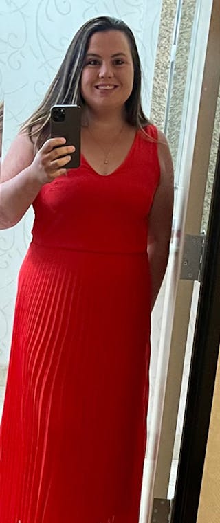 Patients 20-39 Years Old Before & After Gallery - Patient 217716 - Image 2