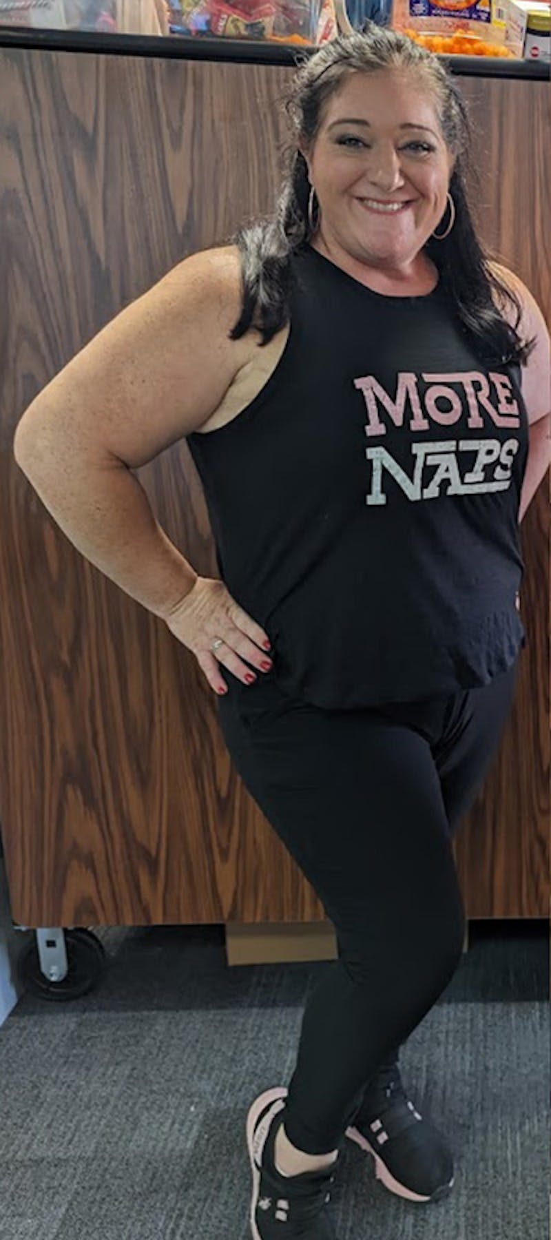 Patients 20-39 Years Old Before & After Gallery - Patient 305696 - Image 1