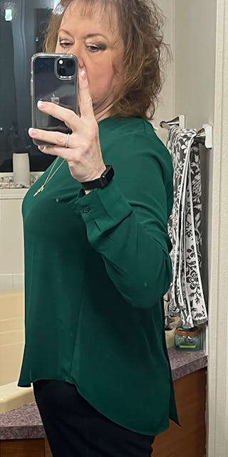 Patients 40-59 Years Old Before & After Gallery - Patient 197042 - Image 2