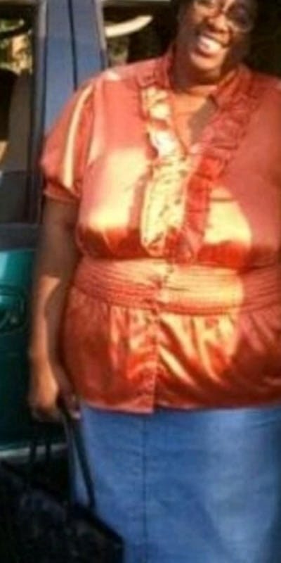 Patients 40-59 Years Old Before & After Gallery - Patient 337517 - Image 1