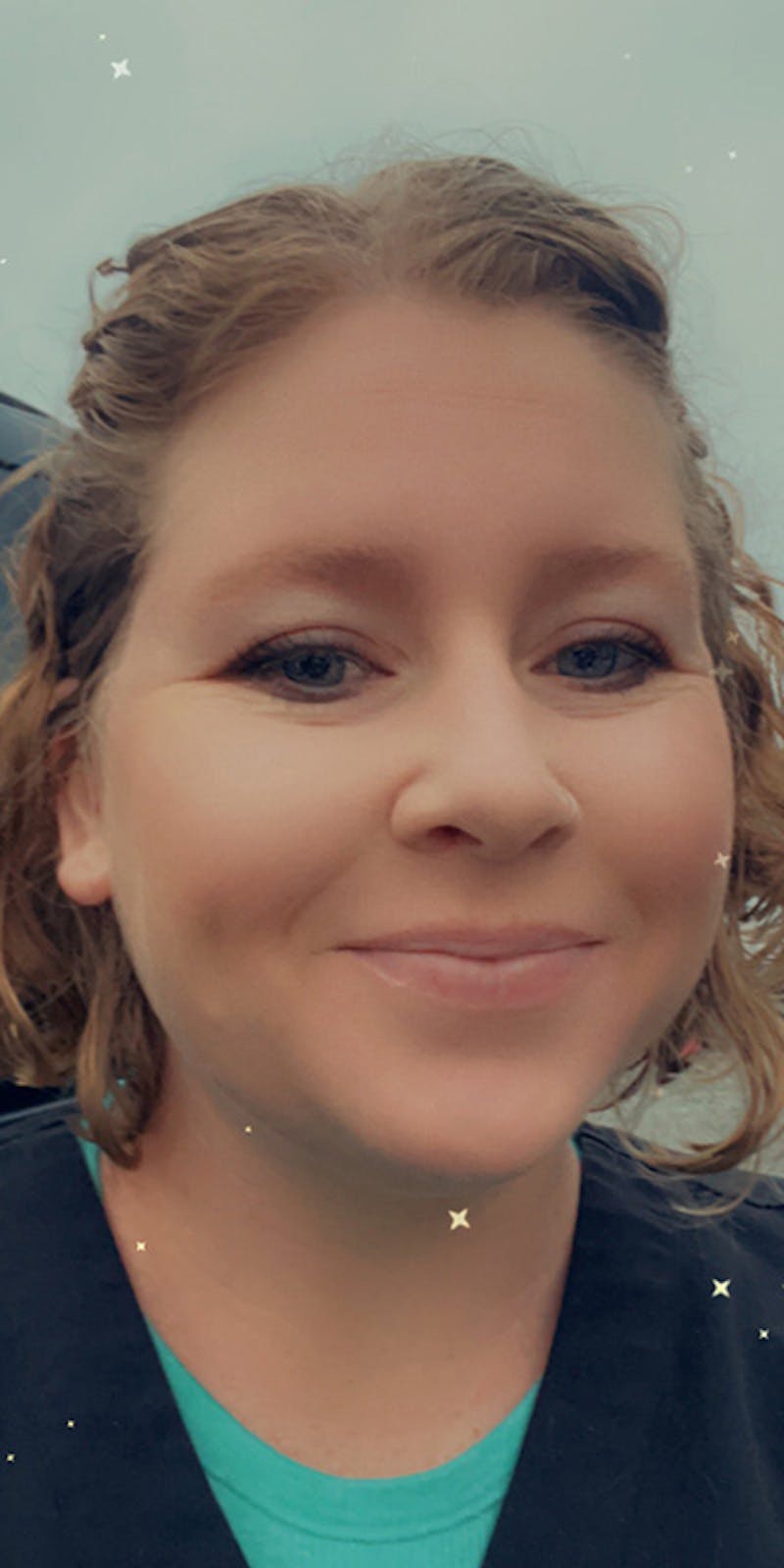 Patients 20-39 Years Old Before & After Gallery - Patient 149205 - Image 1