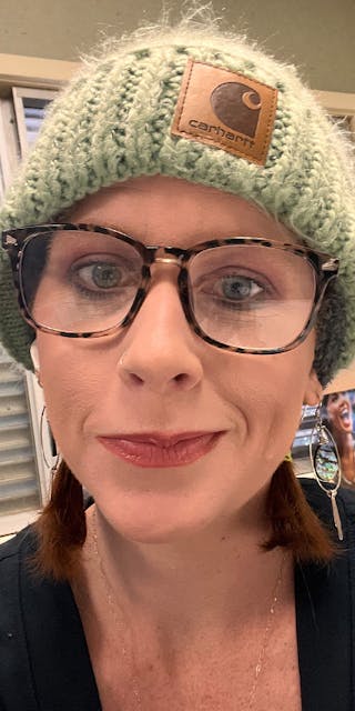 Patients 20-39 Years Old Before & After Gallery - Patient 149205 - Image 2