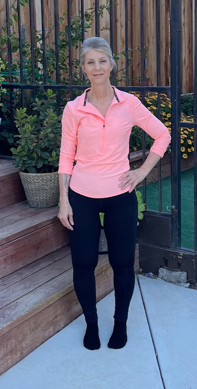 Patients 40-59 Years Old Before & After Gallery - Patient 382953 - Image 2