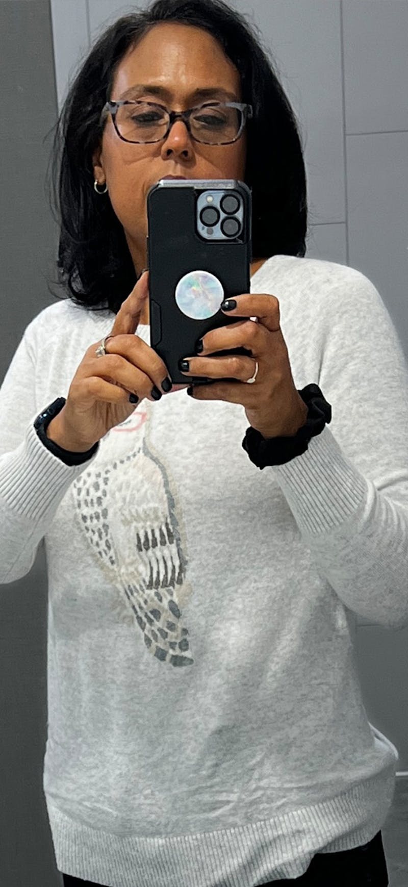 Patients 40-59 Years Old Before & After Gallery - Patient 309920 - Image 2