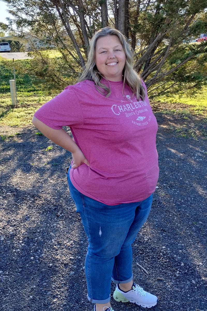 Patients 20-39 Years Old Before & After Gallery - Patient 304910 - Image 1