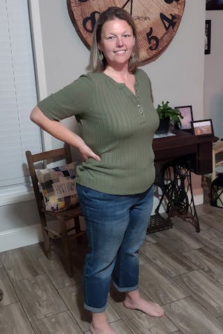 Patients 20-39 Years Old Before & After Gallery - Patient 304910 - Image 2