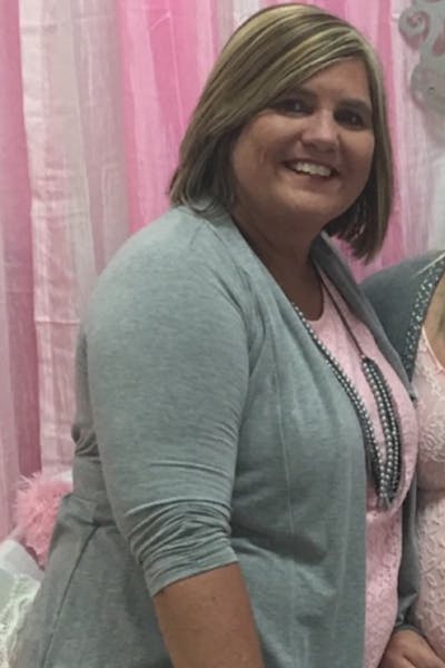 Patients 40-59 Years Old Before & After Gallery - Patient 314346 - Image 1